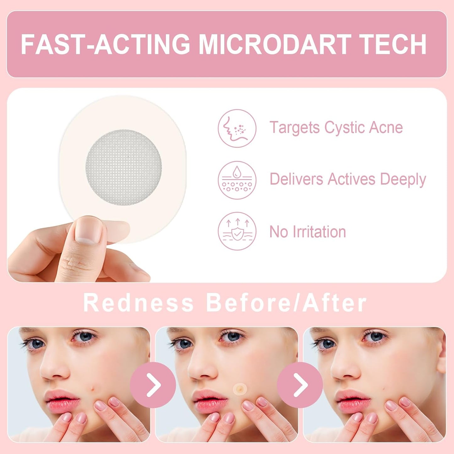 Pimple Patches Set with Microdart Pimples Patche and Hydrocolloid Patch – 3-Step Acne Kit for Fast Blemish Removal, Blackhead Extractor Tools, Zit Patches for Face