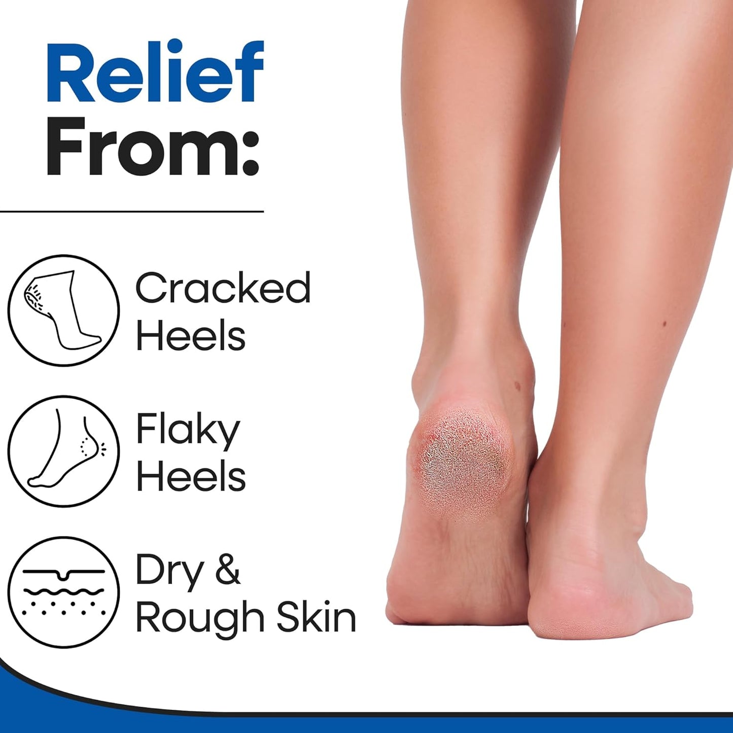 Moisturizing Socks for Men & Women | Cracked Heel Treatment with Aloe Vera | Moisturizer Heel Callus Remover | Aloe Socks for Cracked Heels & Dry Feet | Lotion Gel Sleeves (X-Large - Black)