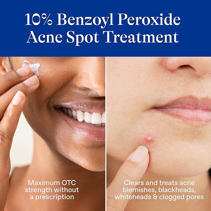 Differin Acne Spot Treatment with 10% Benzoyl Peroxide, Maximum Strength OTC Acne Treatment, Fast Acting Spot Treatment for Face, 1 oz